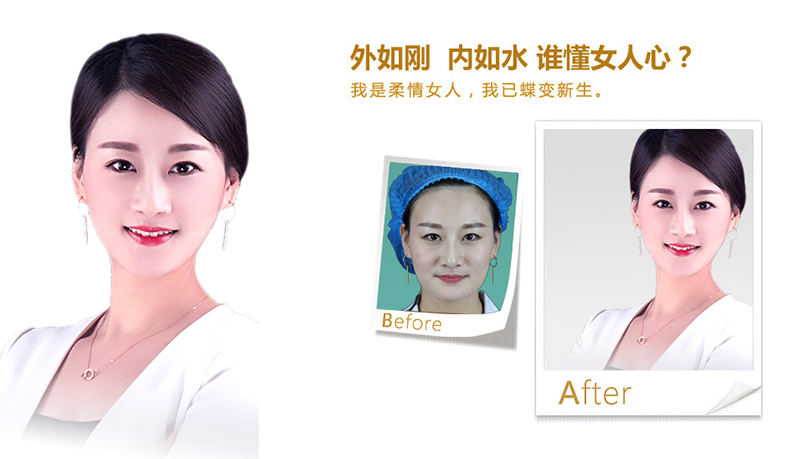 林芝地区V脸、线雕隆鼻